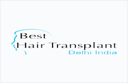 best hair transplant surgery delhi india