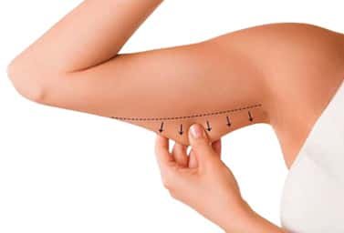 arm lift procedure clinic in delhi